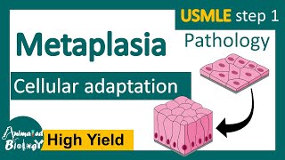 Metaplasia  Cellular adaptation  examples of metaplasia [upl. by Schreibe162]