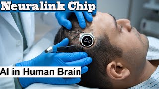 Neuralink chip  The Start of HumanMachine Evolution [upl. by Ariaek366]