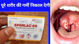 यह 2 ₹ गोली पस्त पेचिश मुह के छाले पेट की इन्फेक्शन ठीक करेगी  Sporlac Ds Tablets Uses in Hindi [upl. by Candra821]