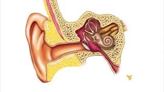 Menieres Disease  WVU Medicine Health Report [upl. by Cantlon23]