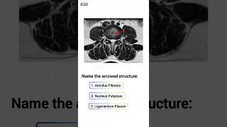 🧠 Anatomy Quiz Spine 🧠 anatomy radiologybuzz [upl. by Sue]