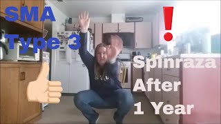 Spinraza Before 6 months and after 1 year [upl. by Shell77]