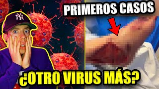 ALERTA por VIRUS FLiRT o KP3 nueva variante del COVID [upl. by Yentirb]