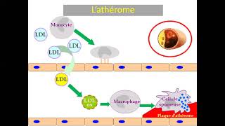 17Syndromes coronariens aigus ST Pr Nibouche  Cardio [upl. by Yllus]