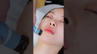 Trayce Exion Face beautytreatment skincare beauty exion btlaesthetics [upl. by Nalniuq]