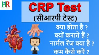 CRP test  CReactive Protein CRP test  CRP test in hindi  High सीआरपी level का क्या मतलब है [upl. by Picco]