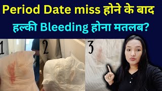 Period Date miss hone ke baad halki Bleeding hona kiya ye Pregnancy hai Implantation Bleeding [upl. by Arem380]