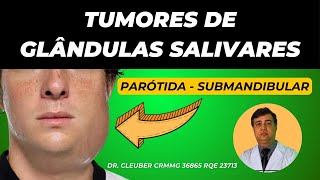 💧 Tumor de Glândula Parótida e Submandibular Desvende o Mistério 💧 [upl. by Maffa]