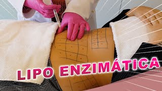 Intradermoterapia enzima para gordura localizada [upl. by Ludovika]