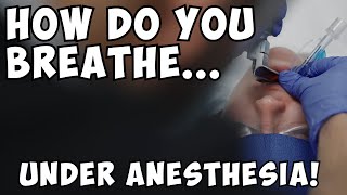 Anesthesia Securing your Airway  Endotracheal Tube and LMAs [upl. by Vale]