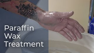 Paraffin Wax Therapy in PostOp Hand Rehabilitation [upl. by Ydissak]