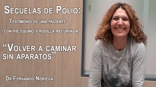 SECUELAS de POLIO TESTIMONIO de una PACIENTE con PIE EQUINO y RODILLA RECURVADA [upl. by Notak503]