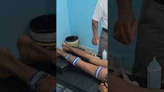 Tens therapy sciatica muscle pain [upl. by Renrag201]