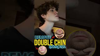 Remove Double Chin Jawline Exercise [upl. by Helbonna]