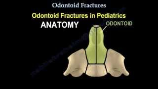 Odontoid Fractures  Everything You Need To Know  Dr Nabil Ebraheim [upl. by Henrik648]