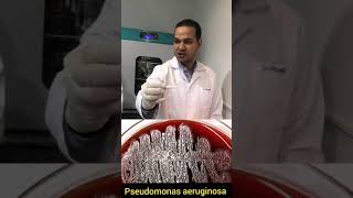 Oxidase test for Pseudomonas aeruginosa 🆚 Enterobacteriaceae شرح بالعربي إجراء اختبار الاوكسديز [upl. by Gnet]