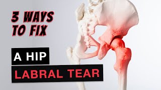 Hip Pain Fix a Hip Labral Tear Fast [upl. by Scriven445]