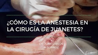 LA ANESTESIA EN LA CIRUGÍA DE JUANETES [upl. by Yrrap]