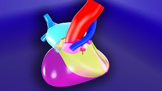 Tetralogy of Fallot  3D Animated Visual Lecture [upl. by Ingraham]