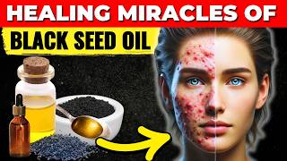 10 Black Seed Oil Benefits 95 of People DONT Know These Health Benefits of Black Seed Oil [upl. by Notrom675]