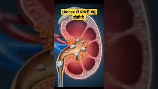 Limcee Tablet Side Effects in Hindi limcee shorts limceetablet [upl. by Reo]