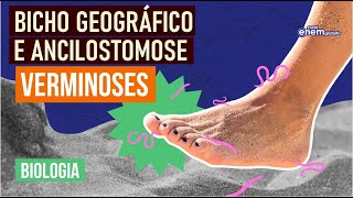 ANCILOSTOMOSE E BICHO GEOGRÁFICO tipos de verminoses  Resumo de Biologia Enem  Cláudia Aguiar [upl. by Celesta549]