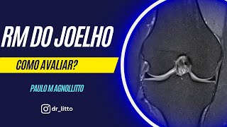 RM DO JOELHO COMO AVALIAR [upl. by Ruddie]