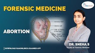 Forensic Medicine  Abortion  Raaonline [upl. by Bullis]