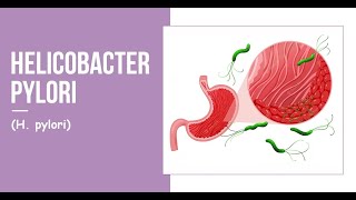 Helicobacter pylori H pylori [upl. by Jump]