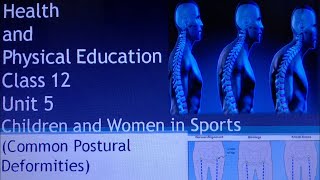 Class 12 Physical Education Unit 5 Common postural deformities2 [upl. by Flore]