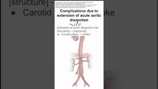 Complications due to extension of acute aortic dissection [upl. by Kucik85]