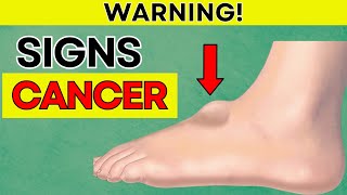 See a Doctor IMMEDIATELY if You have These Signs of Cancer  Daily Joy [upl. by Ahsinad828]