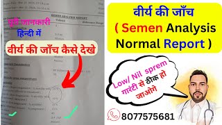 Semen Analysis Normal Report  Result Semen  Report  Semen को समझिये। Medicine  Treatment [upl. by Yesteb]