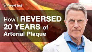 How I Reversed 20 years of Arterial Plaque [upl. by Etnor787]