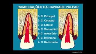 Abertura Coronária e Preparo do Canal Radicular [upl. by Kessiah]