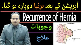 Recurrence of Hernia اگر ہرنیا دوبارہ ہو جاۓ Risk factors Types Treatment Dr Imtiaz Hussain [upl. by Orpha654]