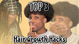 3 Hair Growth Hacks You Need to Try RIGHT NOW [upl. by Aliwt]