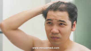 MinoxiMed  1 Formula For Hair Growth amp Thick Beard [upl. by Hsevahb]