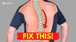 How to Relieve Your Scoliosis Back Pain in 30 SECONDS [upl. by Aracal719]