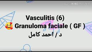 6 Granuloma faciale  GF  👉 Vasculitis By Dr Ahmad Kamel [upl. by Nesnah]