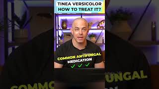 Treat Tinea Versicolor [upl. by Mihar]