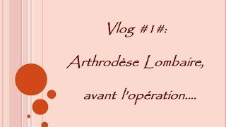 Vlog 1 Arthrodèse Lombaire avant lopération [upl. by Adnovahs608]