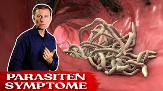 Die besten Kräuter gegen Parasiten  Parasiten Symptome  Dr Berg Deutsch [upl. by Tiphane]