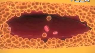 Conjugated Linoleic Acid  CLA [upl. by Moe]