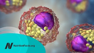 How Low Should You Go for Ideal LDL Cholesterol [upl. by Kela]