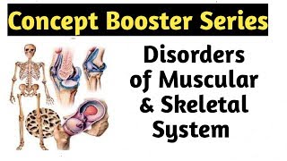 Disorders of Muscular amp Skeletal System  Movement and Locomotion Class 11  NEET Biology [upl. by Nurat]