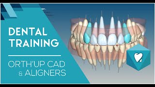 Logiciel CAD dOrthodontie pour aligners  Dental Training about French Align Technology with OrthUp [upl. by Auria]