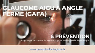 Glaucome aigu à angle fermé et sa prévention par iridotomie laser Pole ophtalmologique [upl. by Arbua]