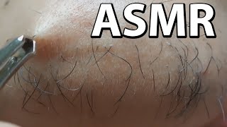 ASMR Plucking facial hair Satisfying  pulling out hairs  with tweezers  chin hair plucking [upl. by Aneehsal]