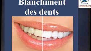 Blanchiment des dents techniques [upl. by Lawrenson]